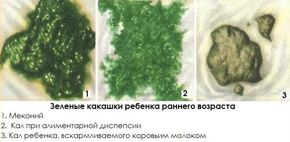 Что делать если у ребёнка понос зелёного цвета?