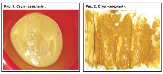 Причины развития белого поноса у взрослых