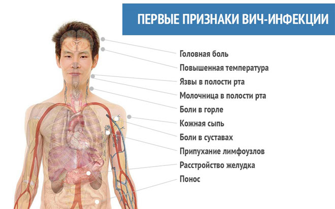 Как проявляется диарея при ВИЧ инфекции и как его лечить?