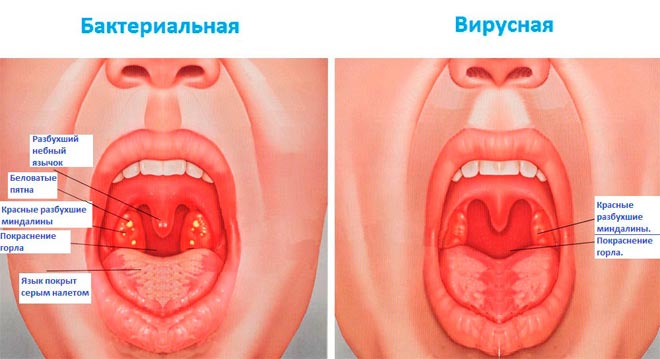 Опасен ли понос и кашель у ребенка без температуры — что нужно знать родителям?